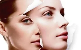 How to Get Rid of Fine Lines and Wrinkles: Botox & Beyond?