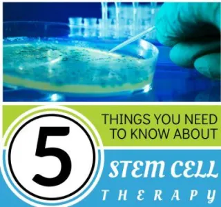 5 Things You Need to Know about STEM CELL THERAPY