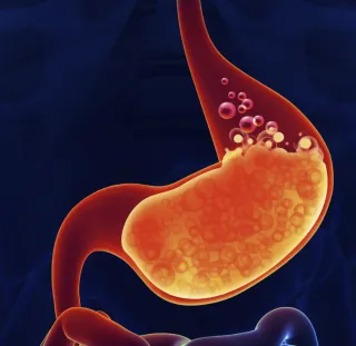 The 3 Rules Of Acid Reflux