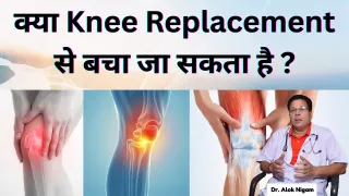 क्या Knee Replacement से बचा जा सकता है?

