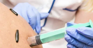 Blutegeltherapie