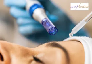 Microneedling