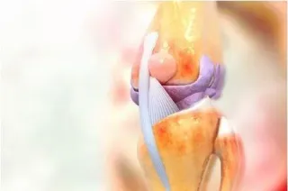 "Joint Pain Unraveled: What’s Really Happening Inside Your Body"