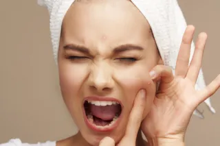 Understanding Acne: Types, Causes, and Effective Treatments for Clear Skin