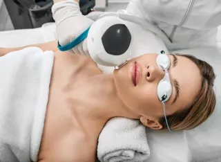 IPL Acne Reduction: Venus Versa for Stubborn Breakouts