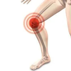 Exercise Therapy, Inflammation, and Cartilage Health