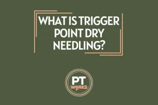 What is Trigger Point Dry Needling?