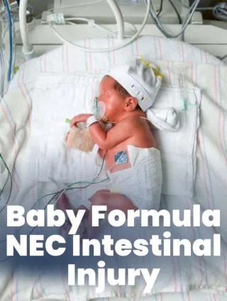 NEC Baby Formula Lawsuit 2025: Filing Claims for Premature Infant Harm