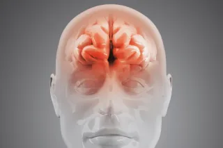 HEADACHES
