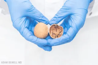 TESTICULAR PAIN