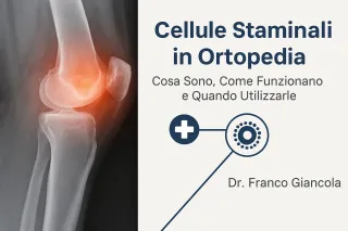 Cellule Staminali in Ortopedia: Cosa Sono, Come Funzionano e Quando Utilizzarle – Dr. Franco Giancola