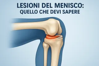 COME CAPIRE SE IL MENISCO E' LESIONATO DURANTE UNA PARTITA DI CALCETTO