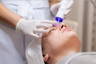 Unlock radiant skin with photofacial and laser treatments in St. Peters, MO