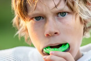 Sports and Smiles: Why Every Athlete Needs a Mouthguard