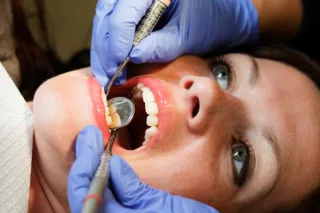 The Importance of Oral Cancer Screenings: What Every Patient Should Know
