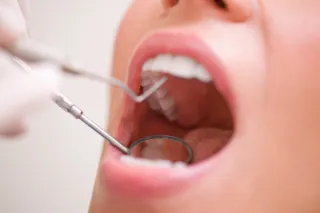Dental Exam & Cleaning