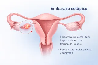 Embarazo ectópico: señales de alarma y diagnóstico oportuno - Tijuana