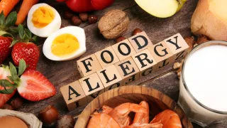 5 Things Doctors Don't Talk About When Treating Your Food Allergies