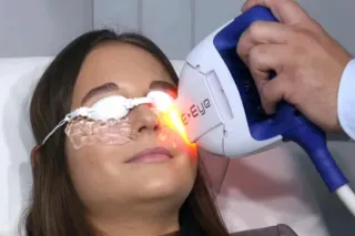 Treating Dry Eyes - What You Should Know