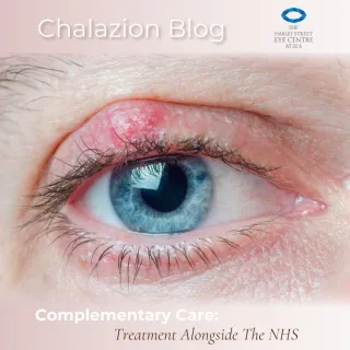 Complementary Care: The Role of Private Chalazion Treatment Alongside the NHS