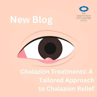 Chalazion Treatments: A Tailored Approach to Chalazion Relief