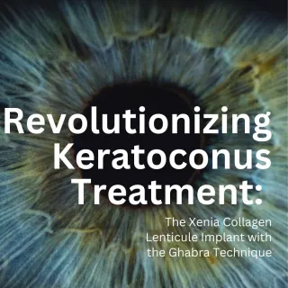 Revolutionizing Keratoconus Treatment: The Xenia Collagen Lenticule Implant with the Ghabra Technique