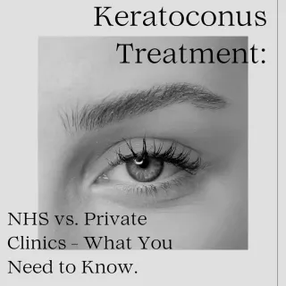 Keratoconus Treatment: NHS vs. Private Clinics - What You Need to Know