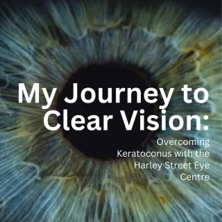 "My Journey to Clear Vision: Overcoming Keratoconus with the Harley Street Eye Centre "