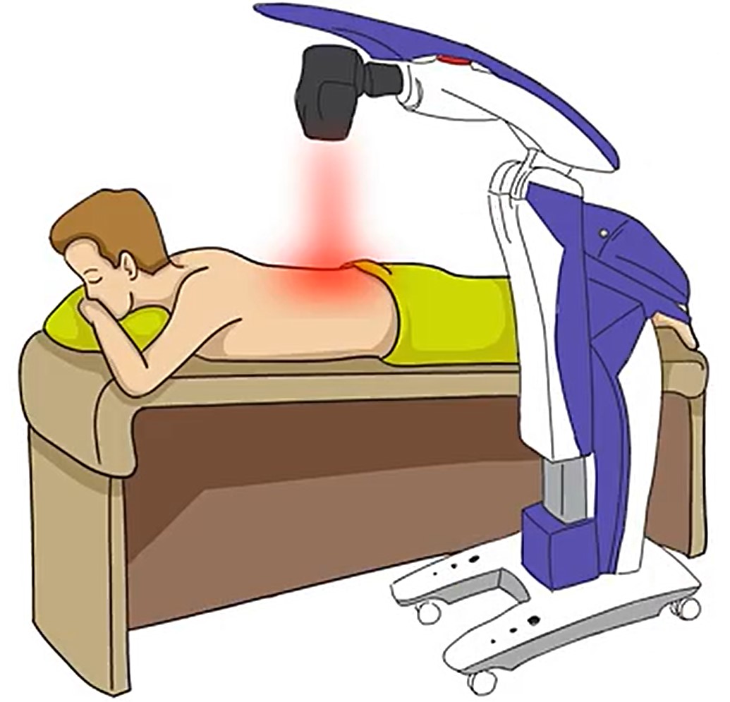 Benefits of MLS Laser Therapy for Pain Relief You Can’t Ignore