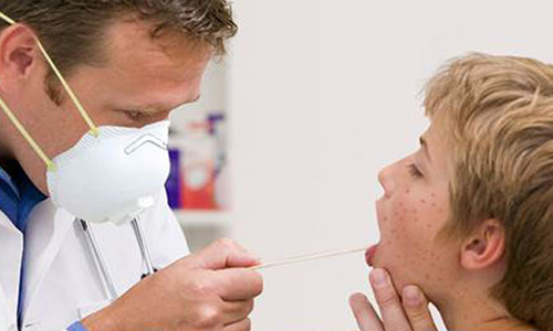 CDC Statement on Measles Outbreak