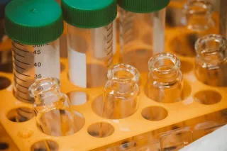 Boosting Quality Management Maturity