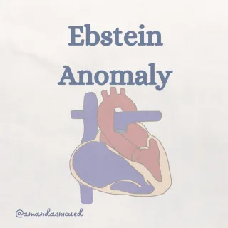 Cyanotic Heart Defects: Ebstein Left 5 Terrible T Pods