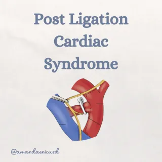 Post Ligation Cardiac Syndrome