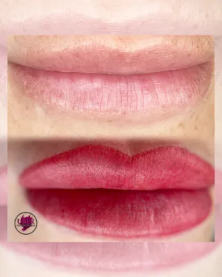 Lip Neutralization