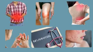 Is It Aging or Inflammation? How to Tell What’s Really Slowing You Down