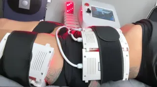 Lipo Laser Aftercare in Stuart, FL