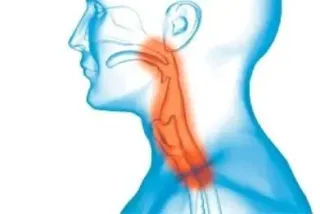 5 Tips For Preventing Vocal Fatigue