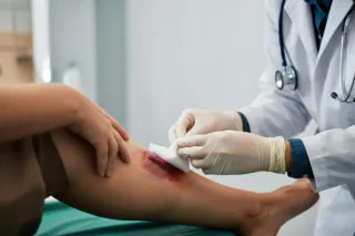 Managing Chronic Wounds: A Comprehensive Guide