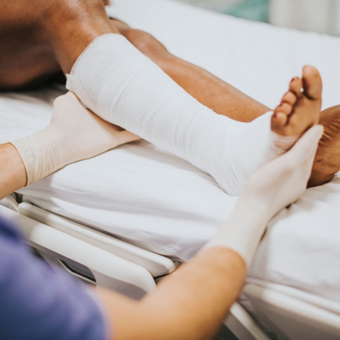 How to Treat Venous Ulcers and Leg Swelling Effectively