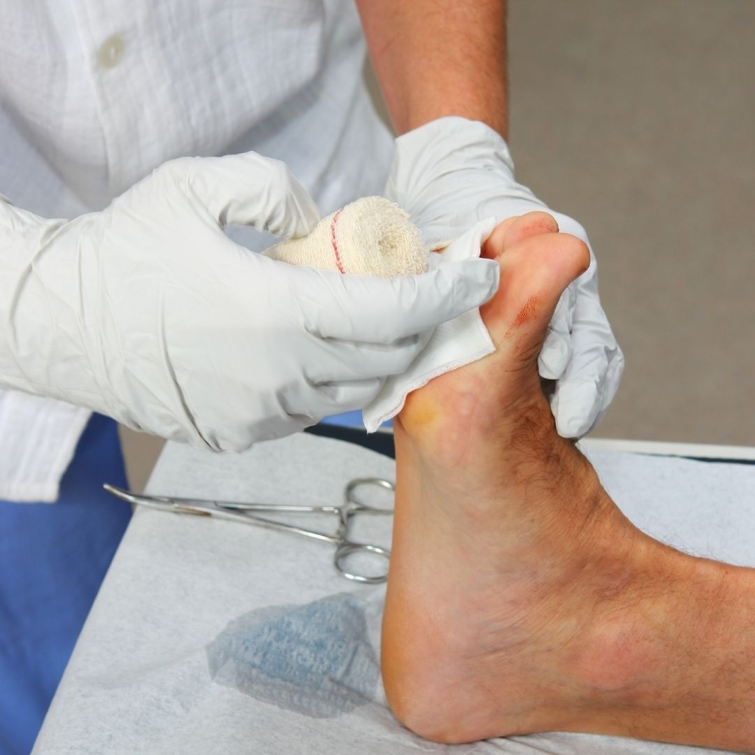 Skin Prep for Wound Care: Best Practices for Proper Healing