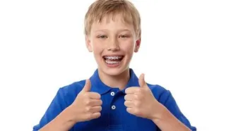 تقويم الأسنان للأطفال