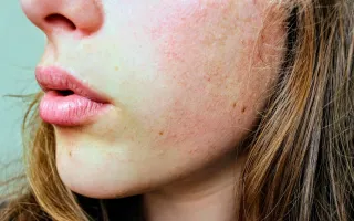 7 Dermatologist-Approved Ways to Treat Common Skin Problems at Home