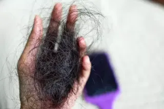 Understanding Sudden Hair Loss: Causes and Solutions