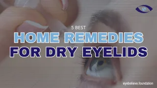 5 Best Home Remedies for Dry Eyelids