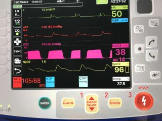 RESUSCITATION: the SCENARIO