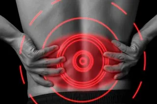 Why Low Back Pain Sufferers Prefer Chiropractic Care
