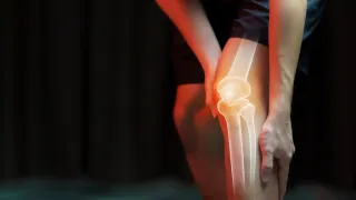 What are 4 causes of CHRONIC KNEE PAIN?