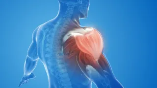 Will FROZEN SHOULDER heal on its own?