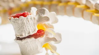 What Happens If You Ignore Degenerative Disc Disease?