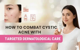How to Combat Cystic Acne with Targeted Dermatological Care